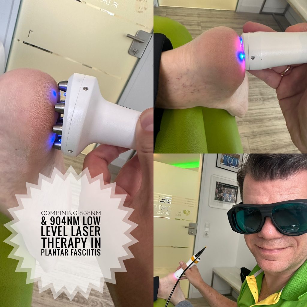 Lavel Laser therapy