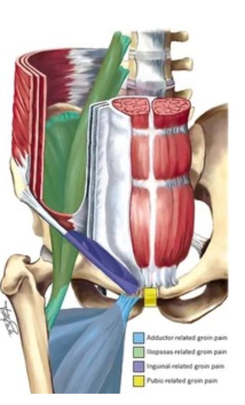 Piriformis-Syndrom: Anatomie der Hüft- und Gesäßmuskulatur